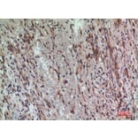 Immunohistochemistry - Anti-PDGFRA Antibody (C30433) - Antibodies.com