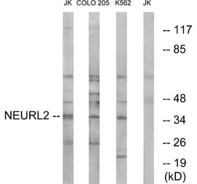 Western Blot - Anti-NEURL2 Antibody (C16905) - Antibodies.com
