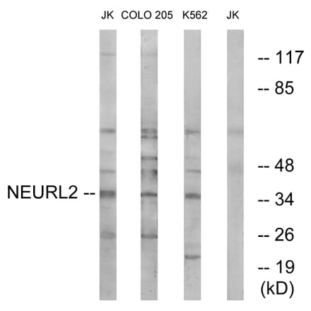 Western Blot - Anti-NEURL2 Antibody (C16905) - Antibodies.com