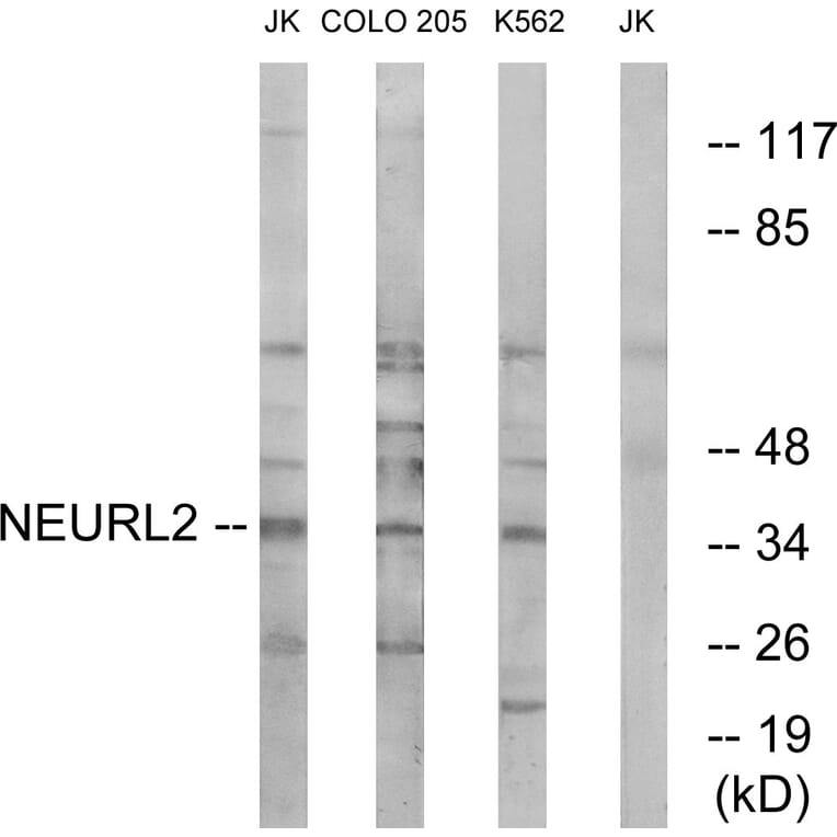 Western Blot - Anti-NEURL2 Antibody (C16905) - Antibodies.com