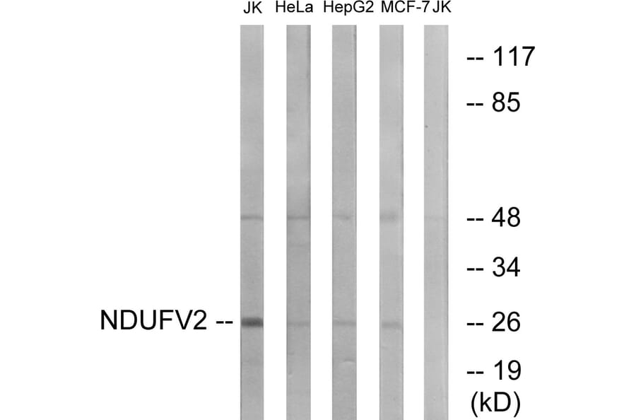 Western Blot - Anti-NDUFV2 Antibody (C16842) - Antibodies.com
