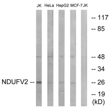 Western Blot - Anti-NDUFV2 Antibody (C16842) - Antibodies.com