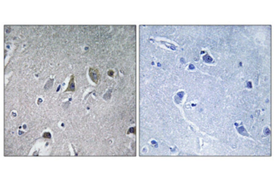 Immunohistochemistry - Anti-NDUFV2 Antibody (C16842) - Antibodies.com