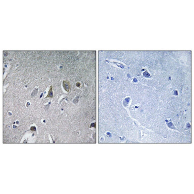 Immunohistochemistry - Anti-NDUFV2 Antibody (C16842) - Antibodies.com