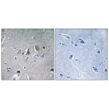 Immunohistochemistry - Anti-NDUFV2 Antibody (C16842) - Antibodies.com