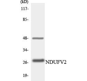 Western Blot - Anti-NDUFV2 Antibody (R12-3086) - Antibodies.com