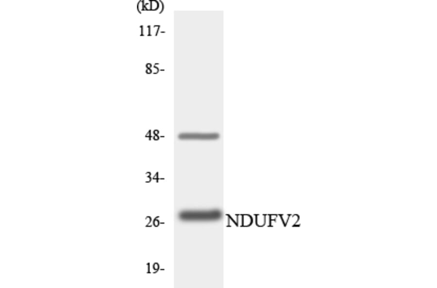 Western Blot - Anti-NDUFV2 Antibody (R12-3086) - Antibodies.com