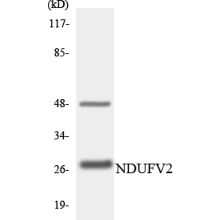 Western Blot - Anti-NDUFV2 Antibody (R12-3086) - Antibodies.com