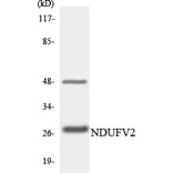 Western Blot - Anti-NDUFV2 Antibody (R12-3086) - Antibodies.com