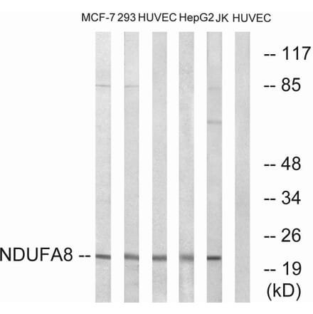 Western Blot - Anti-NDUFA8 Antibody (C16826) - Antibodies.com