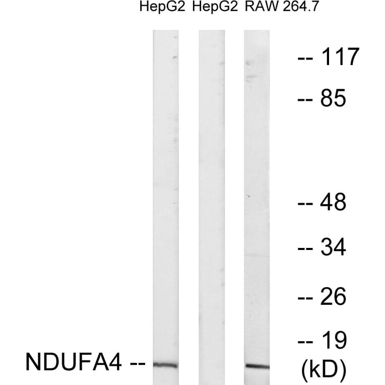 Western Blot - Anti-NDUFA4 Antibody (C16821) - Antibodies.com