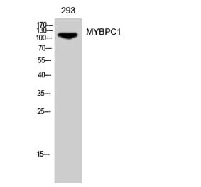 Western Blot - Anti-MYBPC1 Antibody (C16778) - Antibodies.com