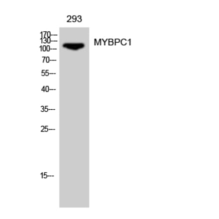 Western Blot - Anti-MYBPC1 Antibody (C16778) - Antibodies.com