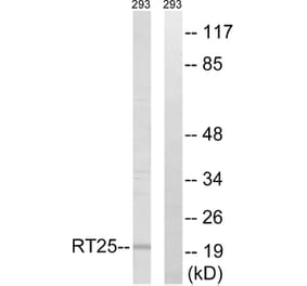 Western Blot - Anti-MRPS25 Antibody (C16655) - Antibodies.com