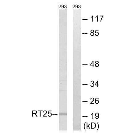 Western Blot - Anti-MRPS25 Antibody (C16655) - Antibodies.com