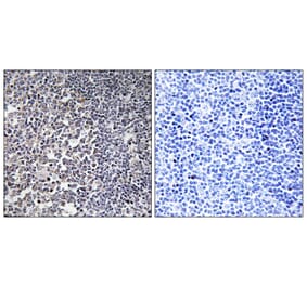 Immunohistochemistry - Anti-MRPS16 Antibody (C14035) - Antibodies.com