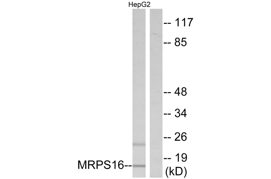 Western Blot - Anti-MRPS16 Antibody (C14035) - Antibodies.com