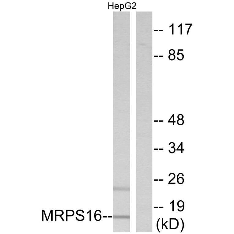 Western Blot - Anti-MRPS16 Antibody (C14035) - Antibodies.com