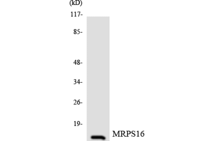 Western Blot - Anti-MRPS16 Antibody (R12-3049) - Antibodies.com