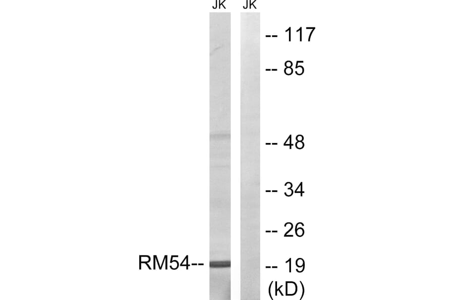 Western Blot - Anti-MRPL54 Antibody (C14052) - Antibodies.com