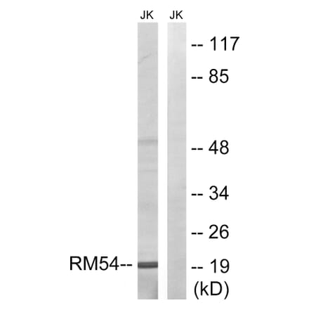 Western Blot - Anti-MRPL54 Antibody (C14052) - Antibodies.com