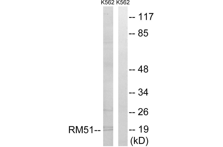 Western Blot - Anti-MRPL51 Antibody (C14085) - Antibodies.com