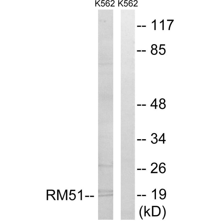 Western Blot - Anti-MRPL51 Antibody (C14085) - Antibodies.com