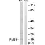 Western Blot - Anti-MRPL51 Antibody (C14085) - Antibodies.com