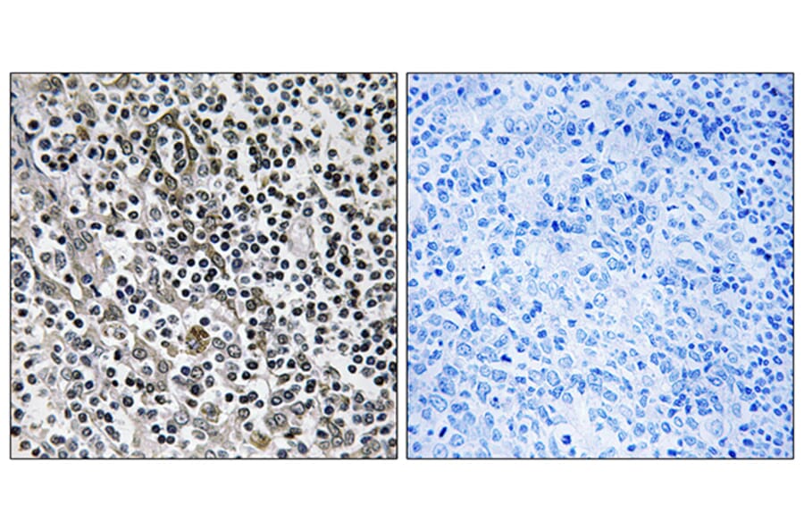 Immunohistochemistry - Anti-MRPL51 Antibody (C14085) - Antibodies.com