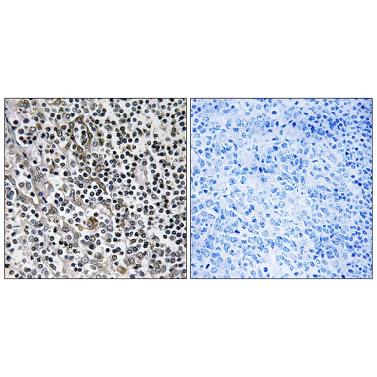 Immunohistochemistry - Anti-MRPL51 Antibody (C14085) - Antibodies.com