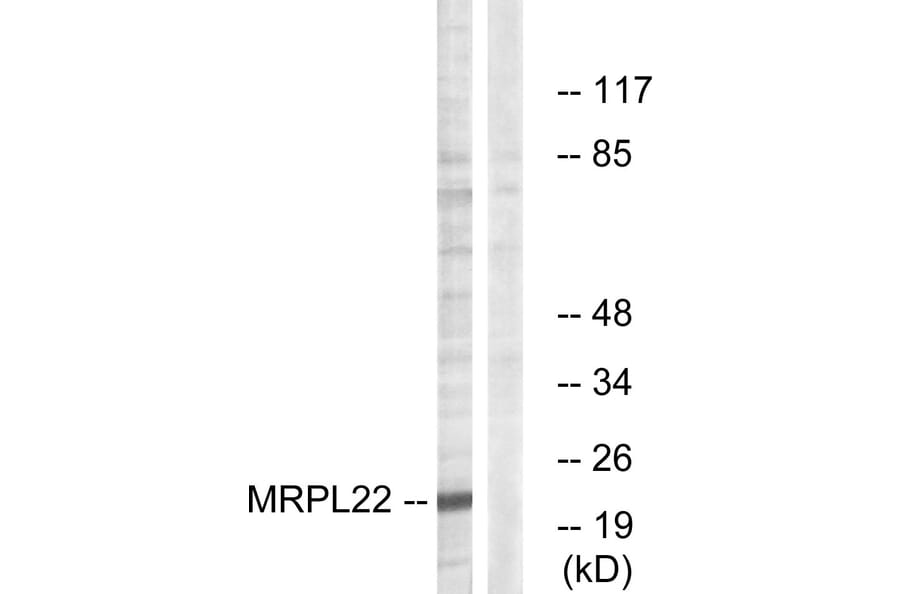 Western Blot - Anti-MRPL22 Antibody (C14067) - Antibodies.com