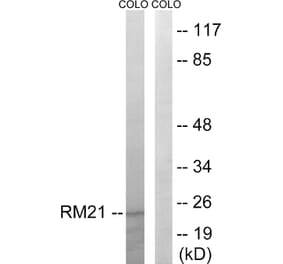 Western Blot - Anti-MRPL21 Antibody (C14066) - Antibodies.com