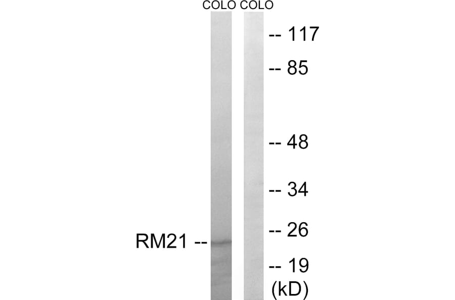 Western Blot - Anti-MRPL21 Antibody (C14066) - Antibodies.com