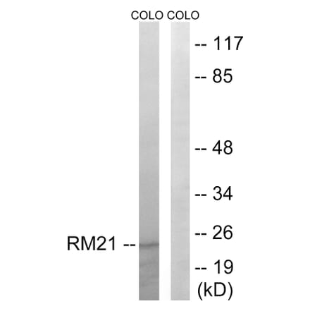 Western Blot - Anti-MRPL21 Antibody (C14066) - Antibodies.com