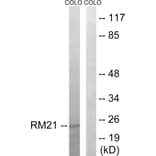 Western Blot - Anti-MRPL21 Antibody (C14066) - Antibodies.com