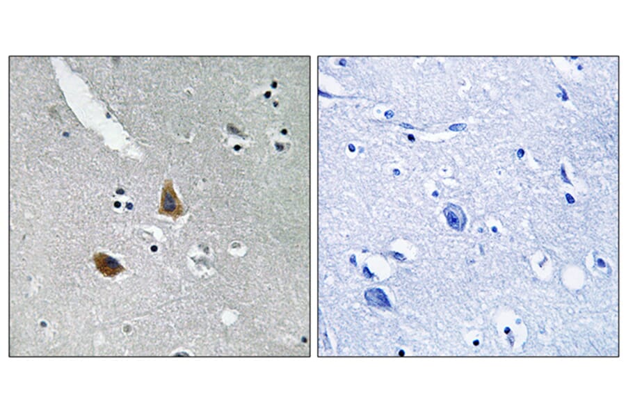 Immunohistochemistry - Anti-MRPL21 Antibody (C14066) - Antibodies.com