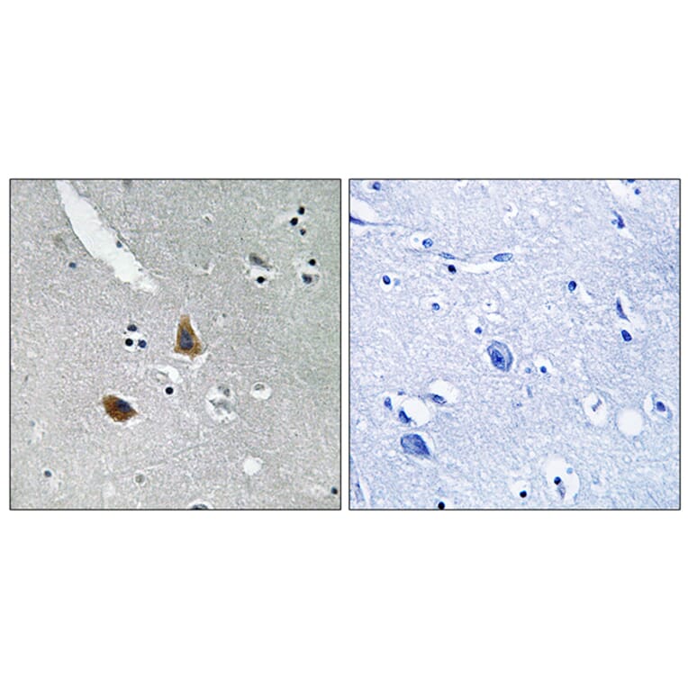 Immunohistochemistry - Anti-MRPL21 Antibody (C14066) - Antibodies.com