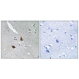 Immunohistochemistry - Anti-MRPL21 Antibody (C14066) - Antibodies.com