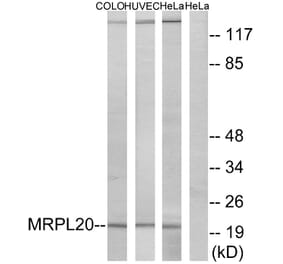 Western Blot - Anti-MRPL20 Antibody (C14065) - Antibodies.com