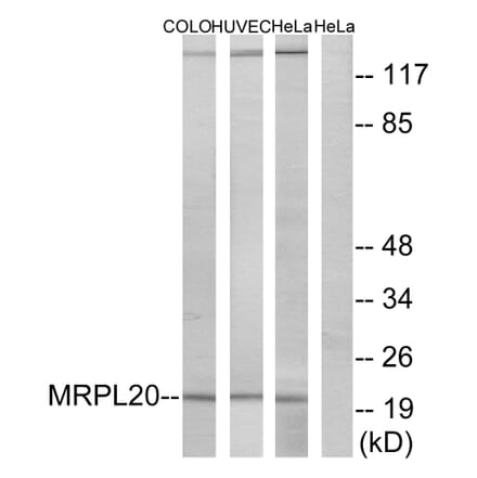 Western Blot - Anti-MRPL20 Antibody (C14065) - Antibodies.com