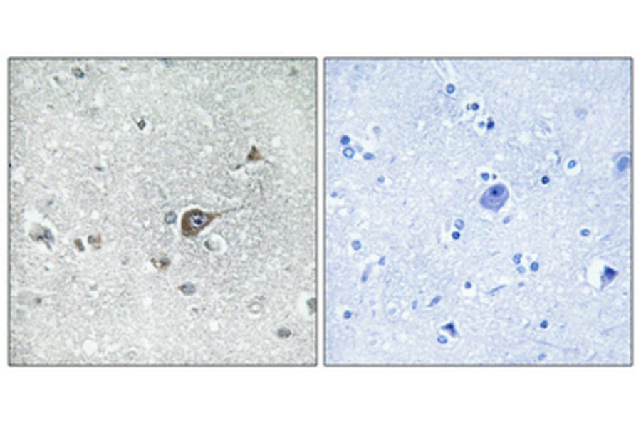 Immunohistochemistry - Anti-MRPL20 Antibody (C14065) - Antibodies.com