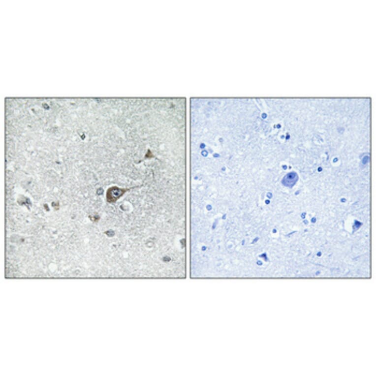 Immunohistochemistry - Anti-MRPL20 Antibody (C14065) - Antibodies.com