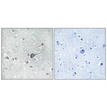 Immunohistochemistry - Anti-MRPL20 Antibody (C14065) - Antibodies.com