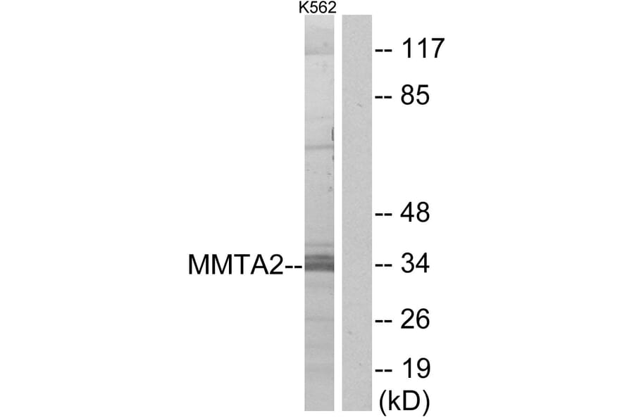Western Blot - Anti-MMTAG2 Antibody (C11613) - Antibodies.com