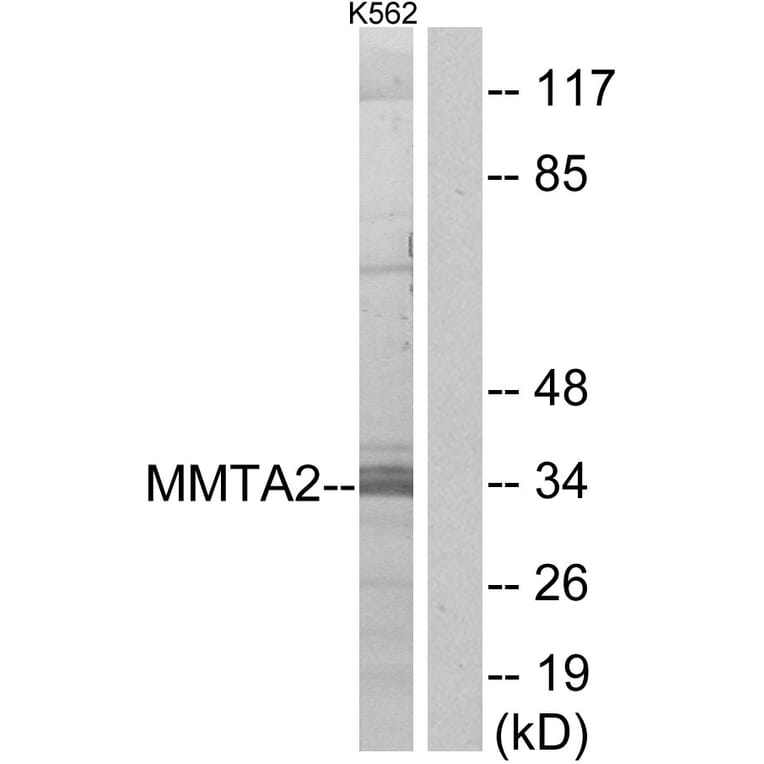 Western Blot - Anti-MMTAG2 Antibody (C11613) - Antibodies.com