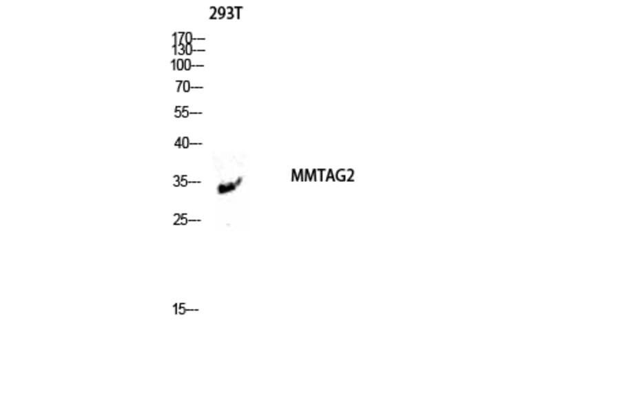 Western Blot - Anti-MMTAG2 Antibody (C11613) - Antibodies.com