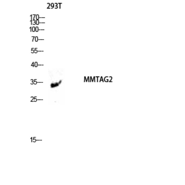 Western Blot - Anti-MMTAG2 Antibody (C11613) - Antibodies.com
