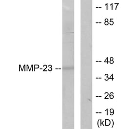 Western Blot - Anti-MMP-23 Antibody (C0271) - Antibodies.com