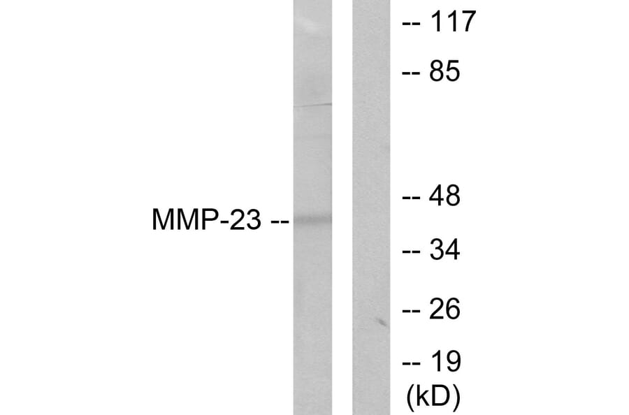 Western Blot - Anti-MMP-23 Antibody (C0271) - Antibodies.com