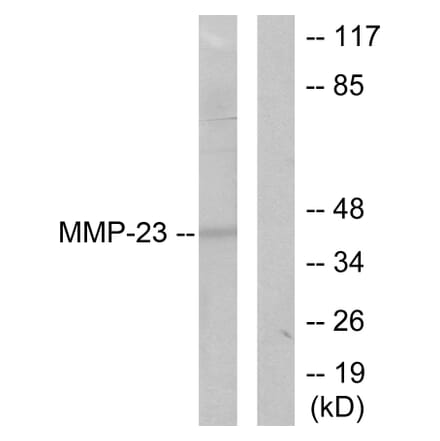 Western Blot - Anti-MMP-23 Antibody (C0271) - Antibodies.com